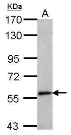 Invitrogen SEMA6C Polyclonal Antibody 100 &mu;L; Unconjugated:Antibodies,