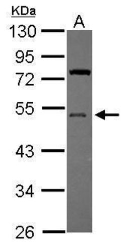 Invitrogen UBA5 Polyclonal Antibody 100 &mu;L; Unconjugated:Antibodies,