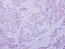 Invitrogen SEPT5 Polyclonal Antibody 100 μL; Unconjugated:Antibodies,