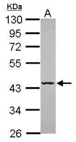 Invitrogen SEPT5 Polyclonal Antibody 100 μL; Unconjugated:Antibodies,