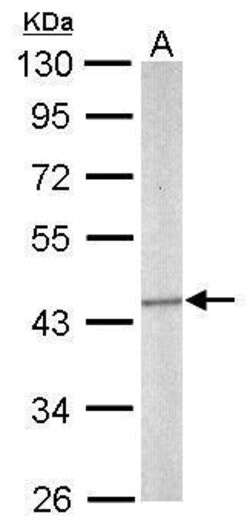 Invitrogen SEPT5 Polyclonal Antibody 100 μL; Unconjugated:Antibodies,