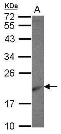 Invitrogen RPL26 Polyclonal Antibody 100 μL; Unconjugated:Antibodies,