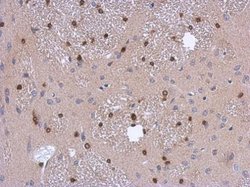 Invitrogen ADI1 Polyclonal Antibody 100 &mu;L; Unconjugated:Antibodies,