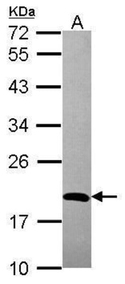 Invitrogen ADI1 Polyclonal Antibody 100 &mu;L; Unconjugated:Antibodies,