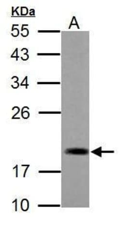 Invitrogen ADI1 Polyclonal Antibody 100 &mu;L; Unconjugated:Antibodies,