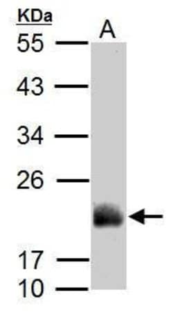 Invitrogen ADI1 Polyclonal Antibody 100 &mu;L; Unconjugated:Antibodies,
