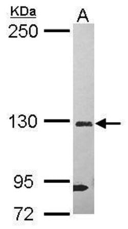 Invitrogen DHX37 Polyclonal Antibody 100 &mu;L; Unconjugated:Antibodies,