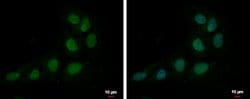 ZNF326 Polyclonal Antibody:Antibodies, Polyclonal