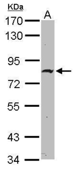 ZNF326 Polyclonal Antibody:Antibodies, Polyclonal
