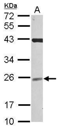 Invitrogen NCE2 Polyclonal Antibody 100 &mu;L; Unconjugated:Antibodies,