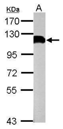 Invitrogen USP13 Polyclonal Antibody 100 &mu;L; Unconjugated:Antibodies,