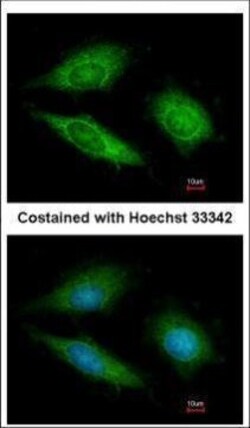 Invitrogen GTPBP9 Polyclonal Antibody 100 &mu;L; Unconjugated:Antibodies,