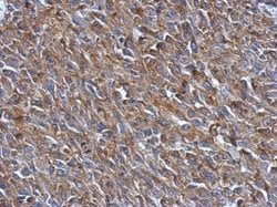 Invitrogen PRPSAP2 Polyclonal Antibody 100 &mu;L; Unconjugated:Antibodies,