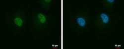 Invitrogen JTV-1 Polyclonal Antibody 100 &mu;L; Unconjugated:Antibodies,