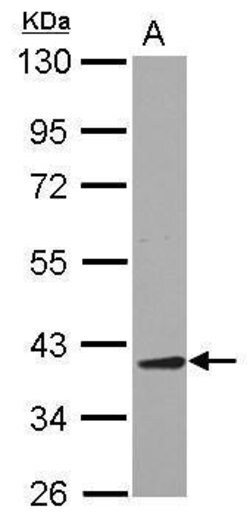 Invitrogen JTV-1 Polyclonal Antibody 100 &mu;L; Unconjugated:Antibodies,