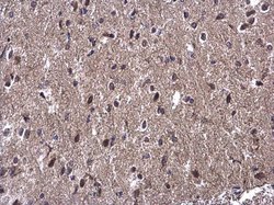 Invitrogen WBP11 Polyclonal Antibody 100 &mu;L; Unconjugated:Antibodies,