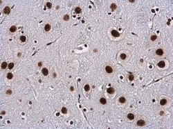Invitrogen WBP11 Polyclonal Antibody 100 &mu;L; Unconjugated:Antibodies,