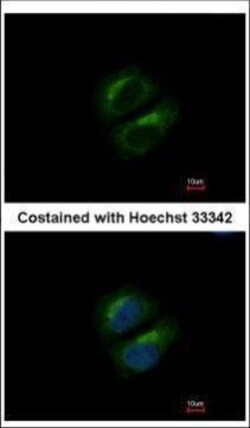 Invitrogen PCBP3 Polyclonal Antibody 100 &mu;L; Unconjugated:Antibodies,