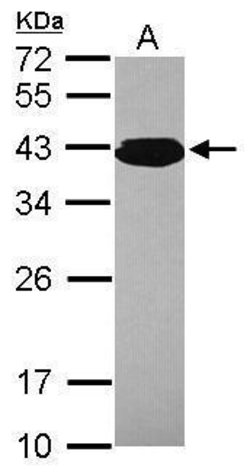 PCBP3 Polyclonal Antibody:Antibodies, Polyclonal