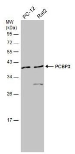 PCBP3 Polyclonal Antibody:Antibodies, Polyclonal