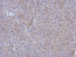 Invitrogen MRPL10 Polyclonal Antibody 100 &mu;L; Unconjugated:Antibodies,