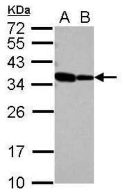 Invitrogen RBM11 Polyclonal Antibody 100 &mu;L; Unconjugated:Antibodies,