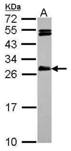 Invitrogen HAUS2 Polyclonal Antibody 100 &mu;L; Unconjugated:Antibodies,