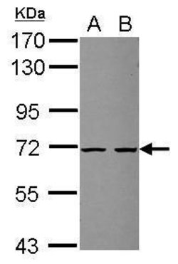 Invitrogen ZSWIM2 Polyclonal Antibody 100 &mu;L; Unconjugated:Antibodies,
