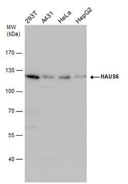 Invitrogen HAUS6 Polyclonal Antibody 100 &mu;L | Buy Online | Invitrogen&trade; | Fisher Scientific