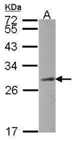 HAUS2 Polyclonal Antibody:Antibodies, Polyclonal