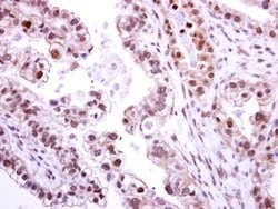 Invitrogen NEK2 Polyclonal Antibody 100 &mu;L; Unconjugated:Antibodies,