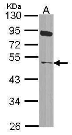 Invitrogen NEK2 Polyclonal Antibody 100 &mu;L; Unconjugated:Antibodies,