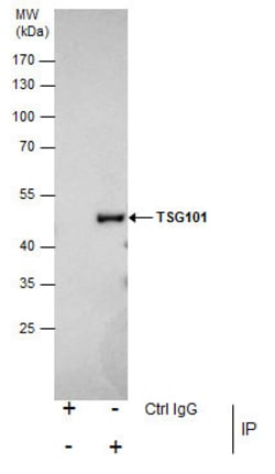 Invitrogen TSG101 Polyclonal Antibody 100 &mu;L; Unconjugated:Antibodies,