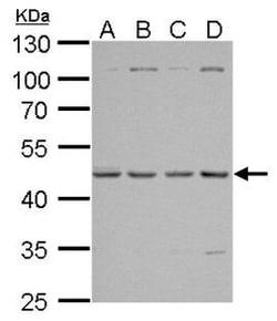 Invitrogen TSG101 Polyclonal Antibody 100 &mu;L; Unconjugated:Antibodies,