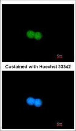 Invitrogen MRE11 Polyclonal Antibody 100 &mu;L; Unconjugated:Antibodies,