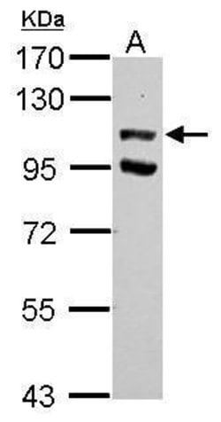 Invitrogen USP37 Polyclonal Antibody 100 &mu;L; Unconjugated:Antibodies,
