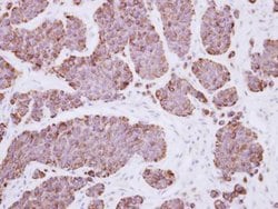 PLEKHF2 Polyclonal Antibody:Antibodies, Polyclonal