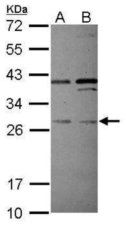 PLEKHF2 Polyclonal Antibody:Antibodies, Polyclonal