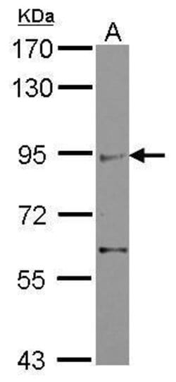 Invitrogen ZMIZ2 Polyclonal Antibody 100 &mu;L; Unconjugated:Antibodies,