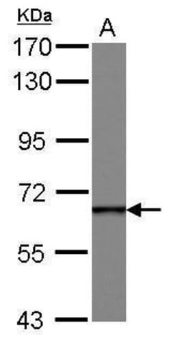 Invitrogen DDX49 Polyclonal Antibody 100 &mu;L; Unconjugated:Antibodies,