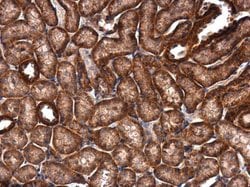 IVNS1ABP Polyclonal Antibody:Antibodies, Polyclonal