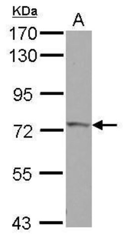 IVNS1ABP Polyclonal Antibody:Antibodies, Polyclonal