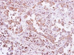 Invitrogen PTPN14 Polyclonal Antibody 100 &mu;L; Unconjugated:Antibodies,
