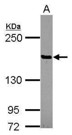 Invitrogen PTPN14 Polyclonal Antibody 100 &mu;L; Unconjugated:Antibodies,