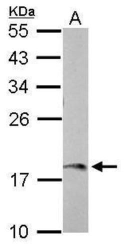AMELX Polyclonal Antibody:Antibodies, Polyclonal