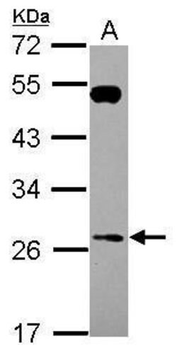 Invitrogen RAB26 Polyclonal Antibody 100 &mu;L; Unconjugated:Antibodies,