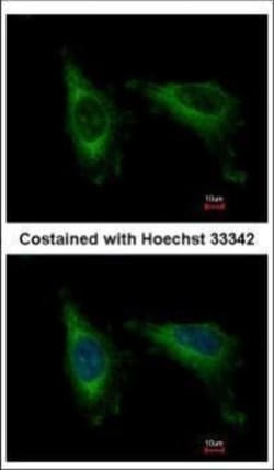 Invitrogen Cdc37L1 Polyclonal Antibody 100 &mu;L | Buy Online | Invitrogen&trade; | Fisher Scientific