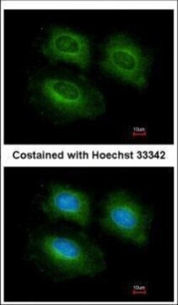 Invitrogen PDE10A Polyclonal Antibody 100 &mu;L | Buy Online | Invitrogen&trade; | Fisher Scientific