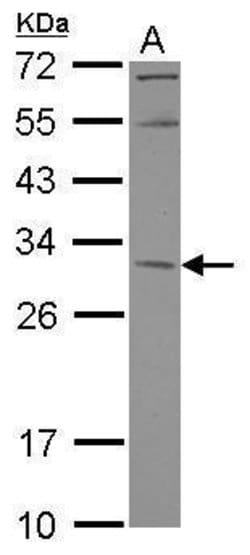 Invitrogen KCTD4 Polyclonal Antibody 100 μL; Unconjugated:Antibodies,