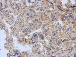 Invitrogen eIF3a Polyclonal Antibody 100 &mu;L; Unconjugated:Antibodies,
